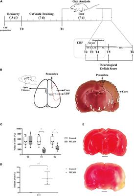 Cerebral Ischemia-Reperfusion Is Associated With Upregulation of Cofilin-1 in the Motor Cortex